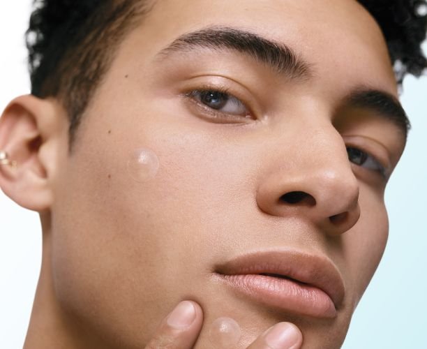 Piel con imperfecciones